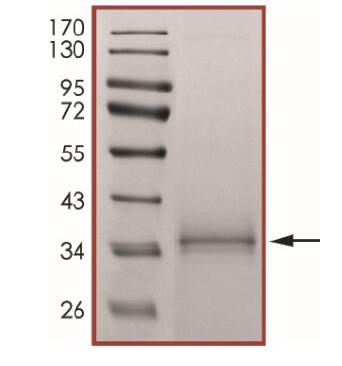 The purity of 2019-nCoV Spike protein S1 subunit, RBD (K417N) was determined to be >90% by densitometry
